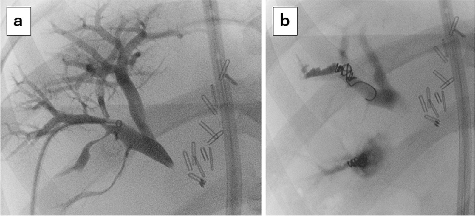 Fig. 6