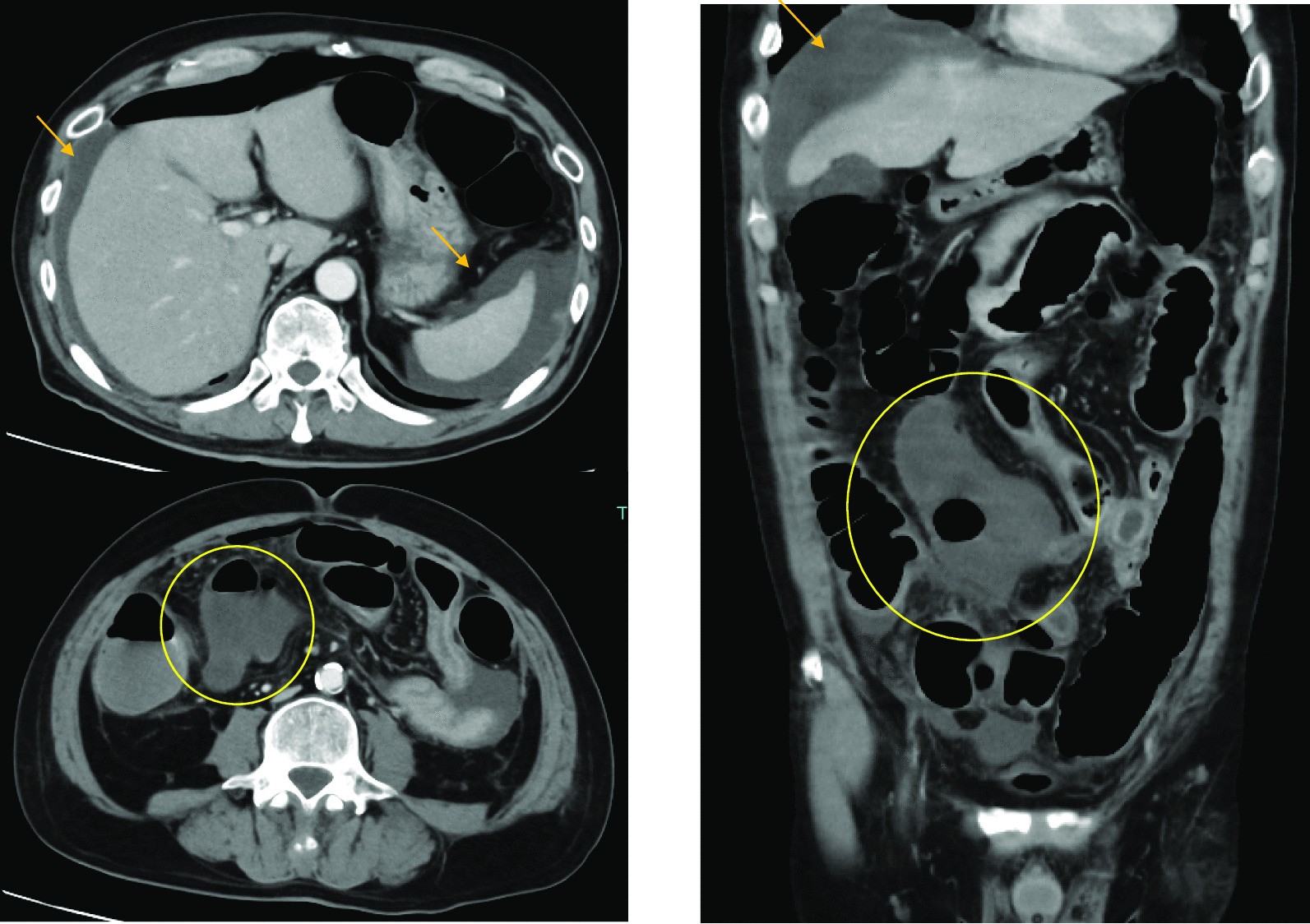 Fig. 2