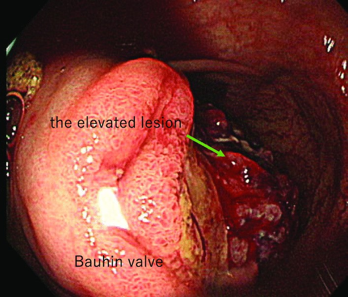 Fig. 2