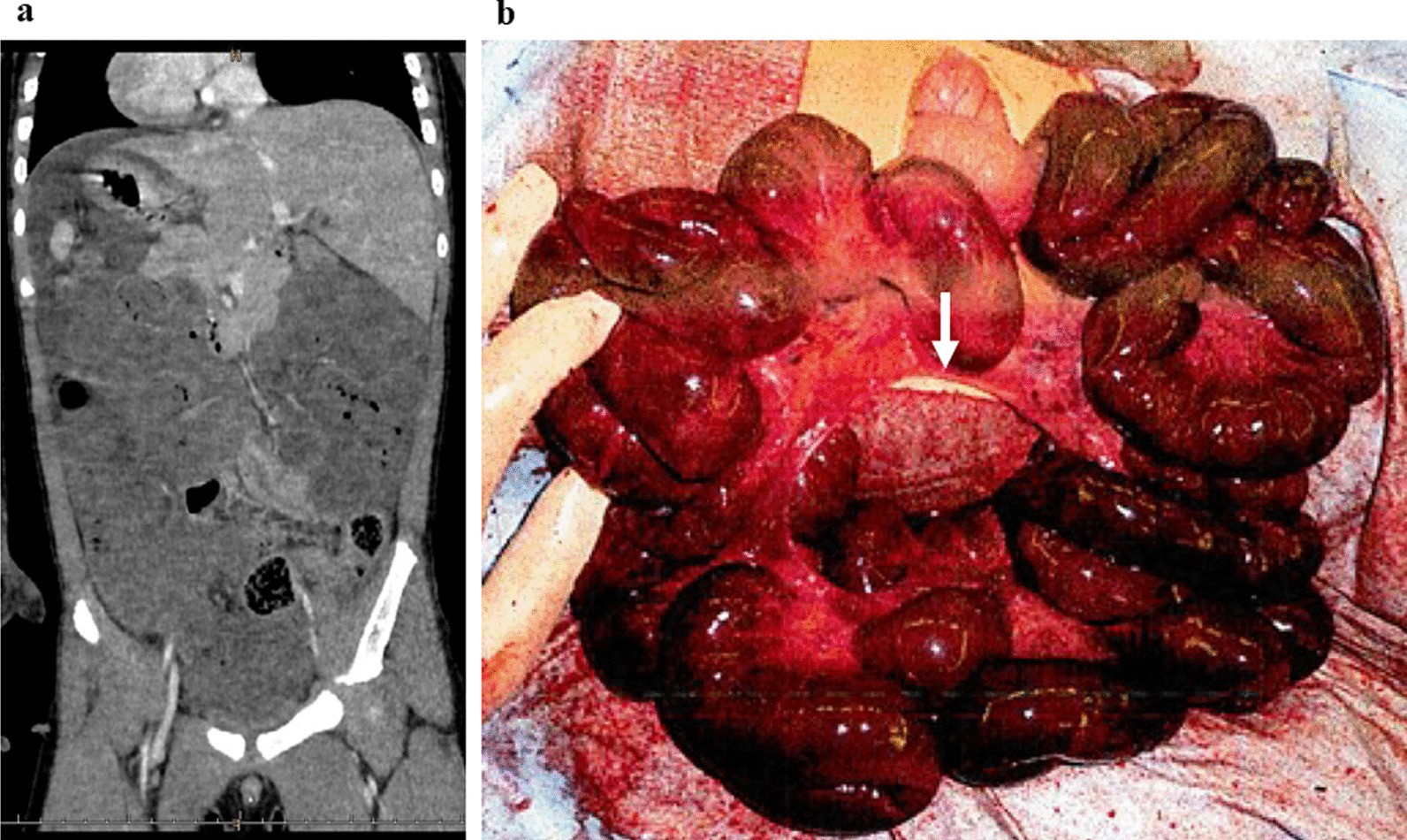 Fig. 1