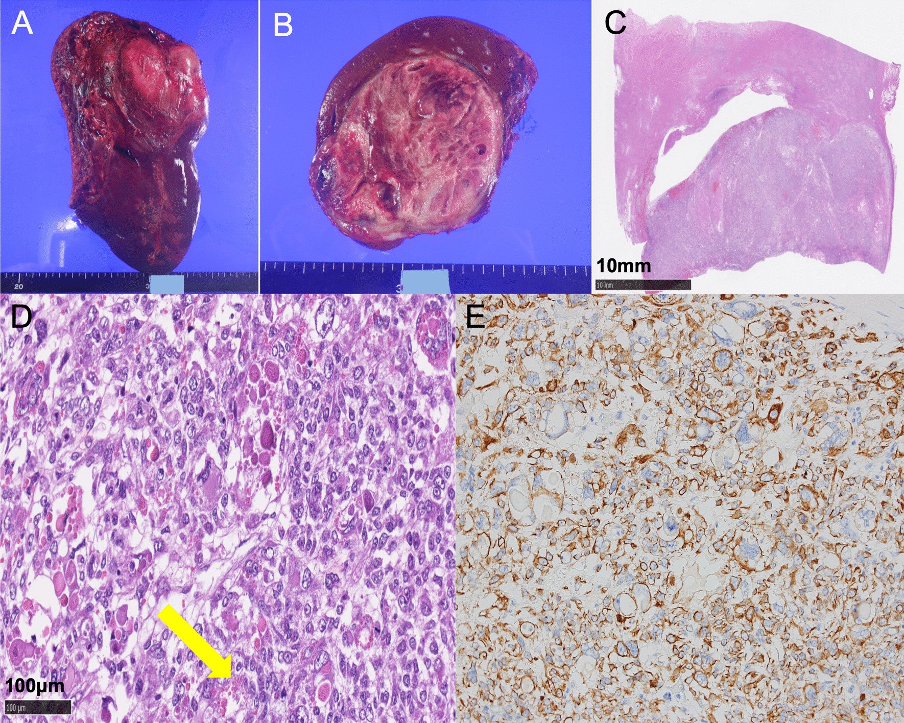 Fig. 2