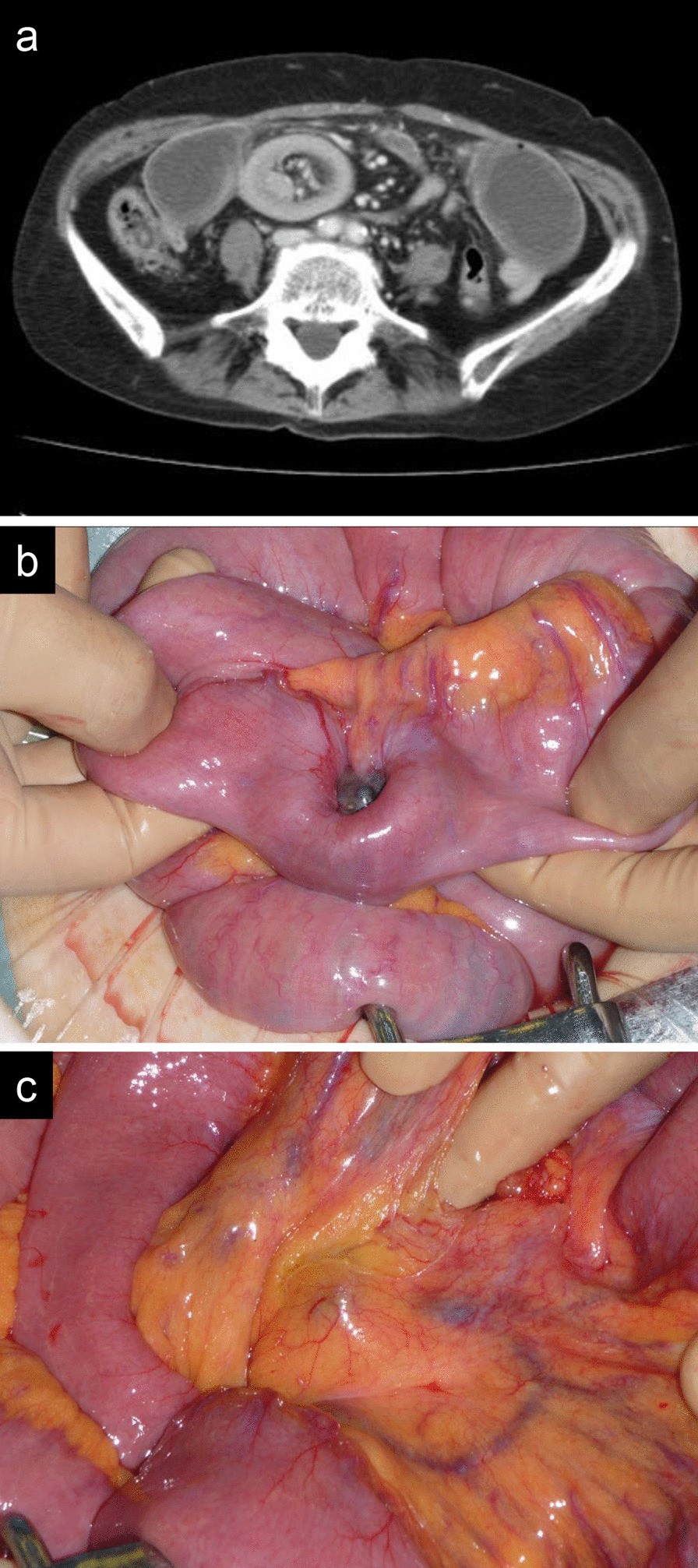 Fig. 2