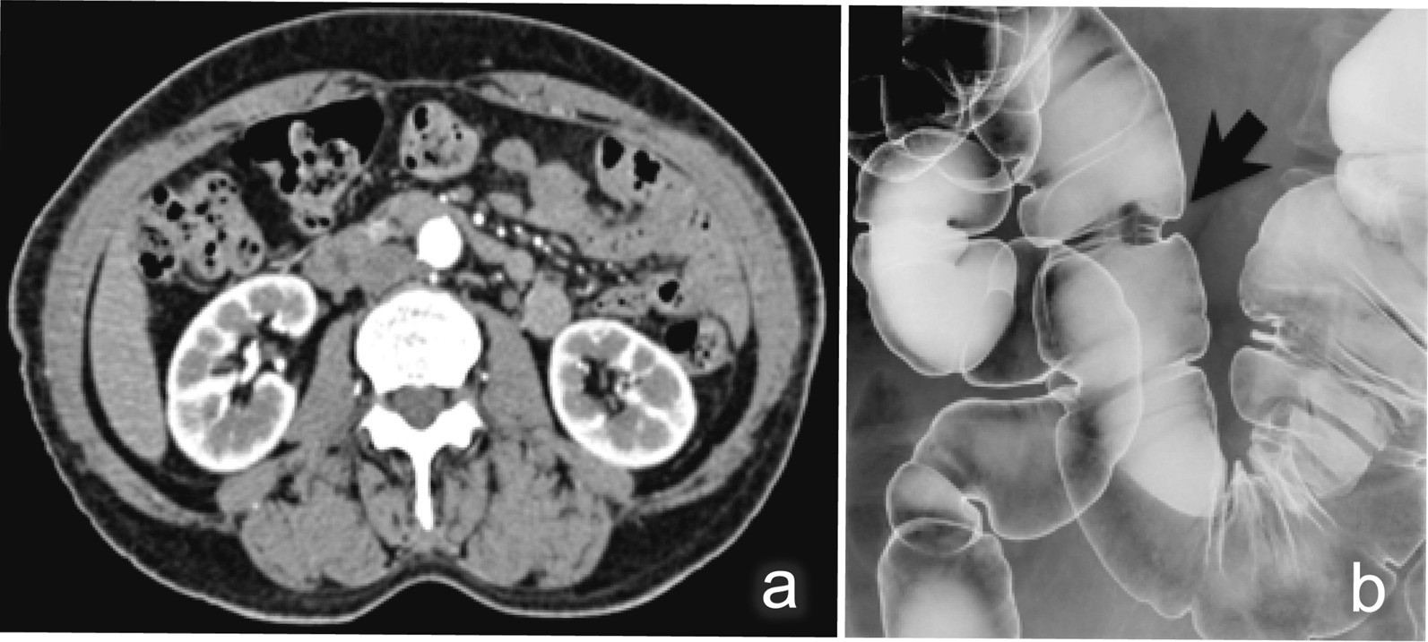 Fig. 2