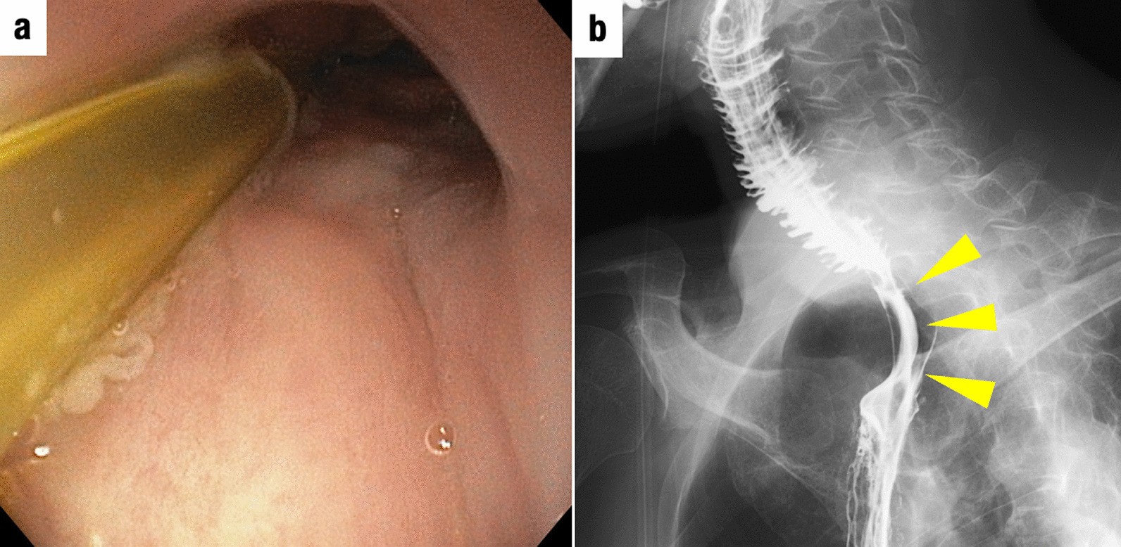 Fig. 4