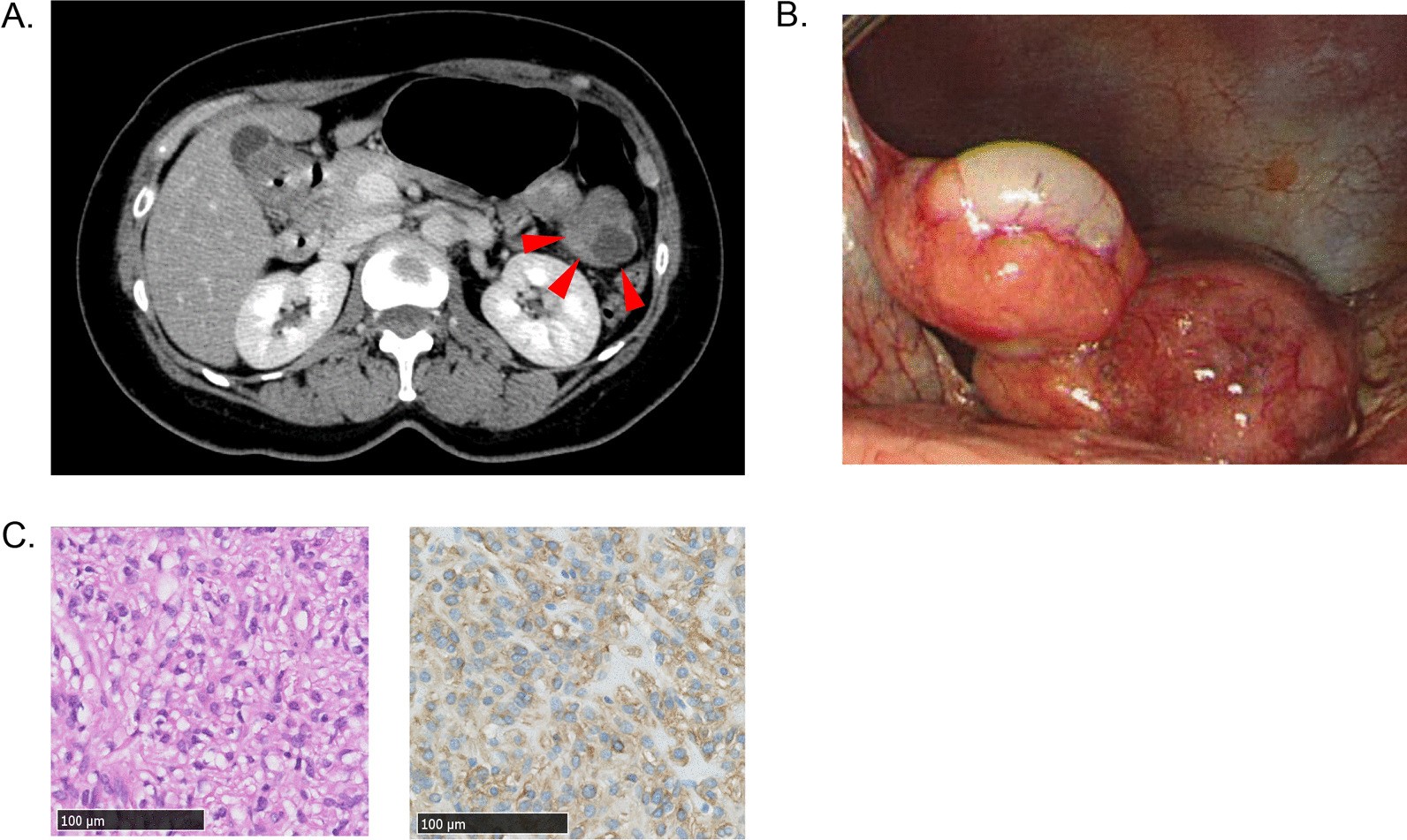 Fig. 1