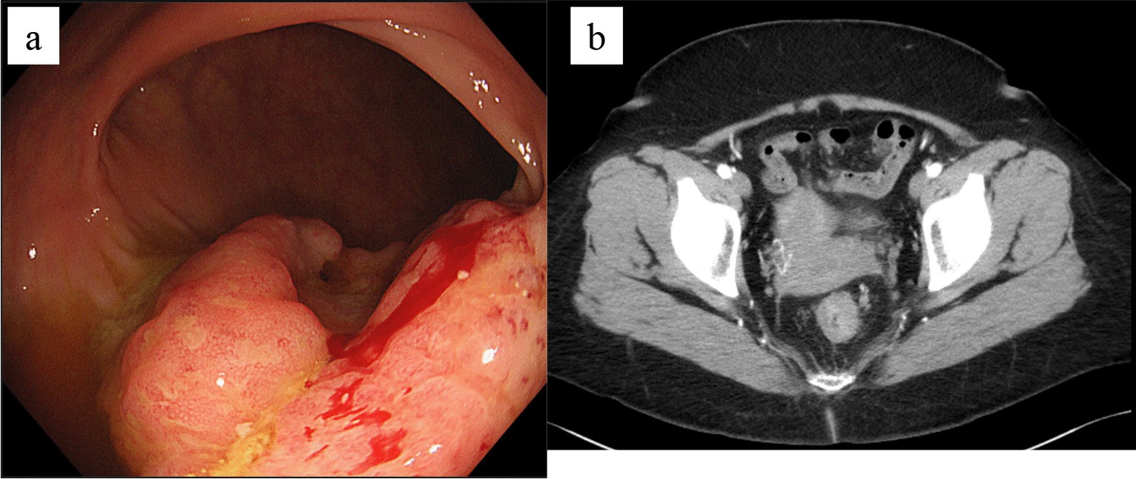 Fig. 1