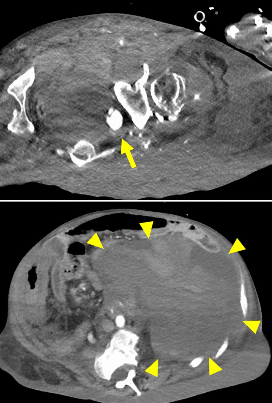 Fig. 1