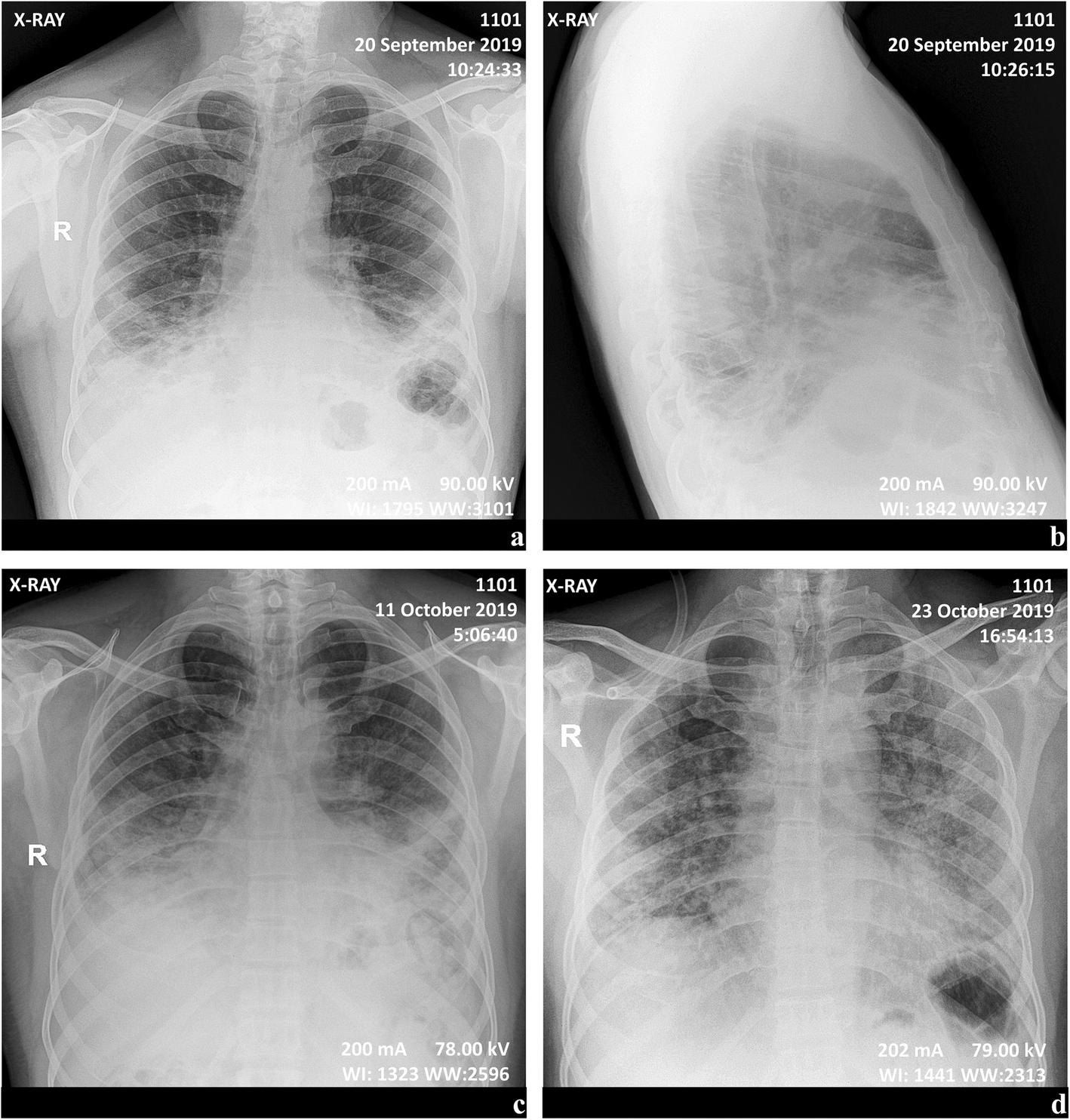 Fig. 1