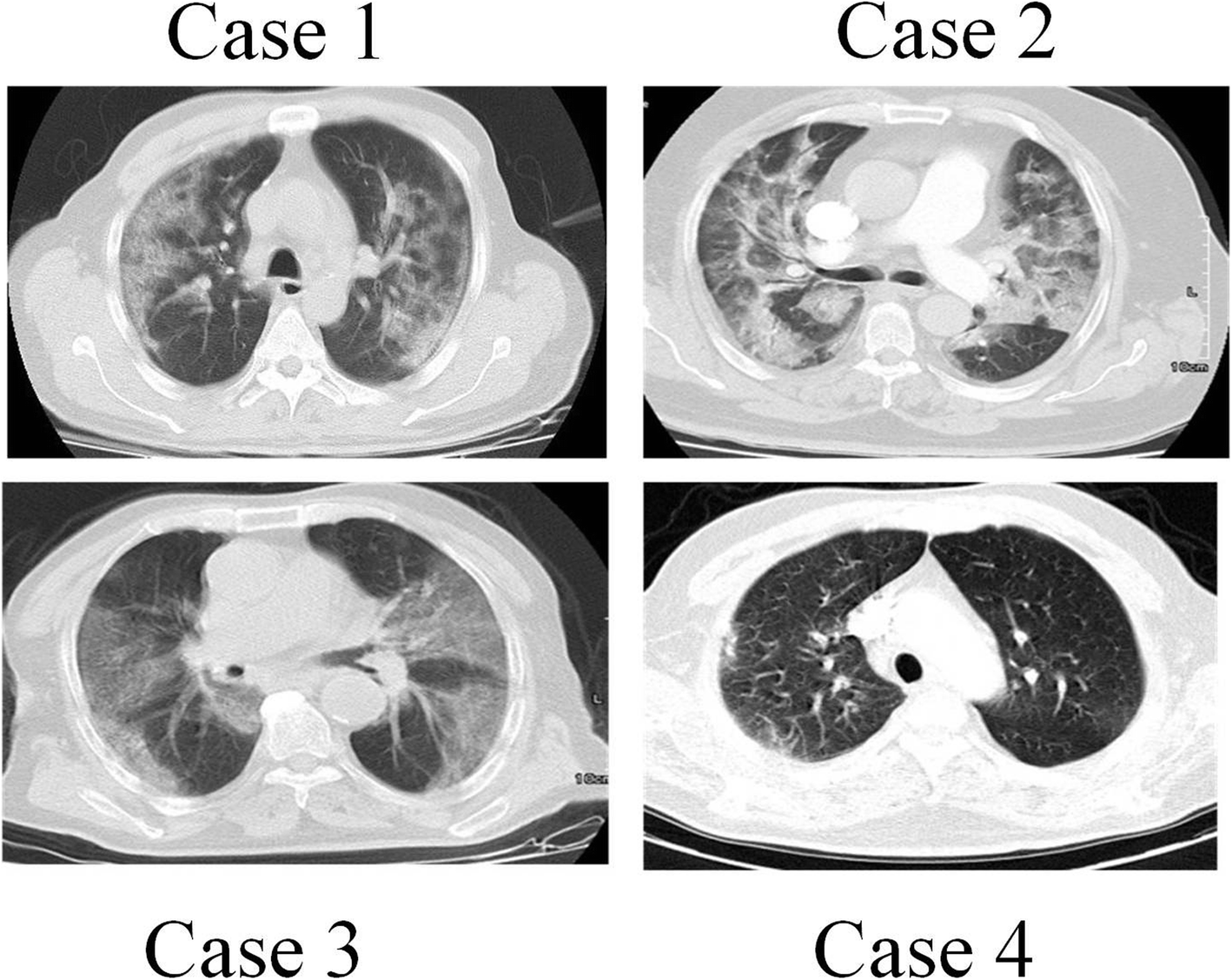 Fig. 1