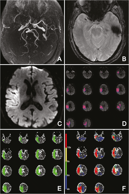 Fig. 5