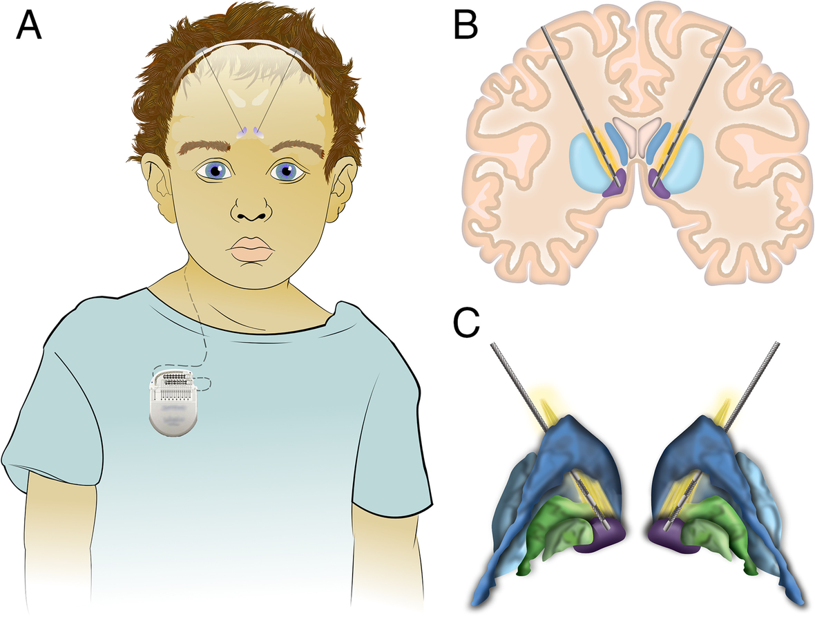 Fig. 1