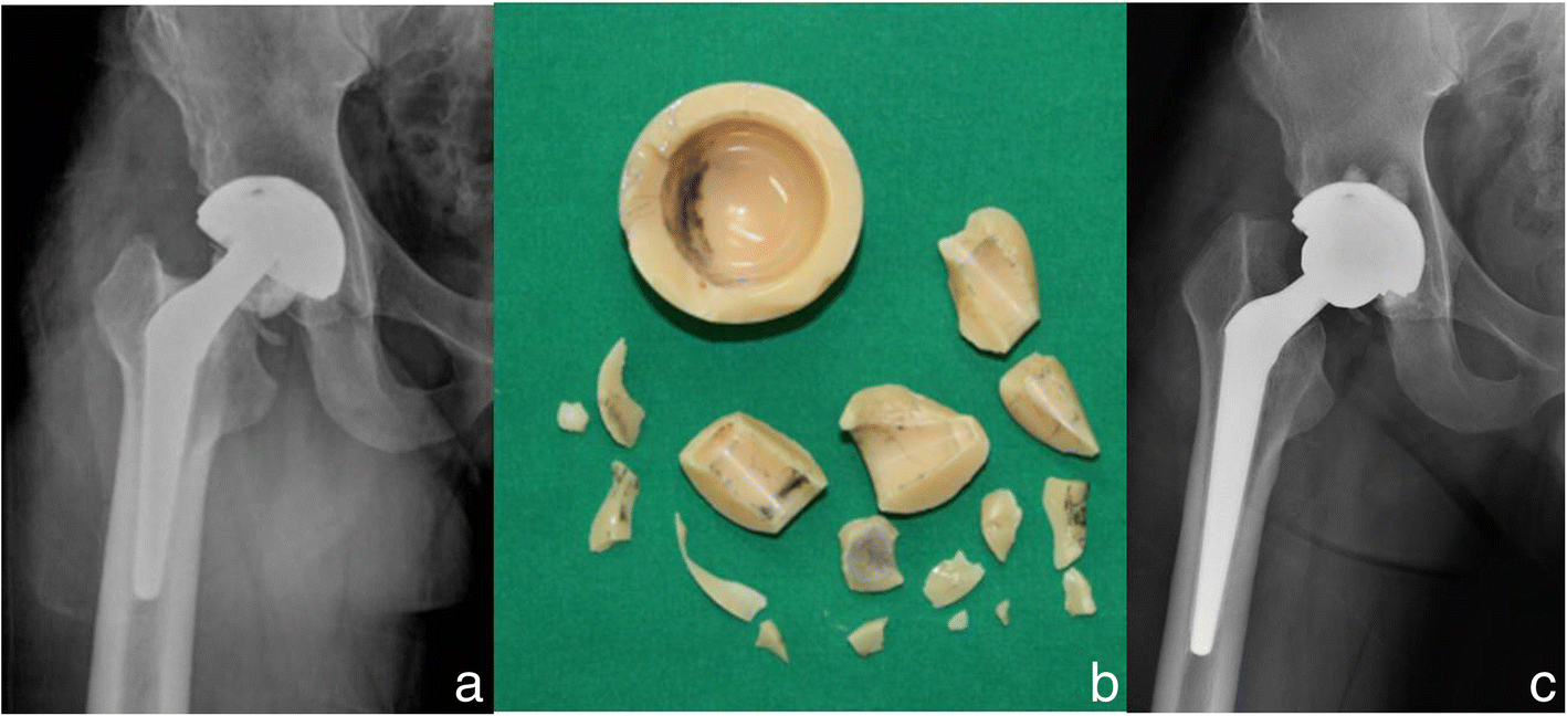 Fig. 5