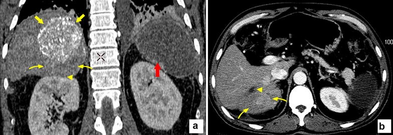 Fig. 2