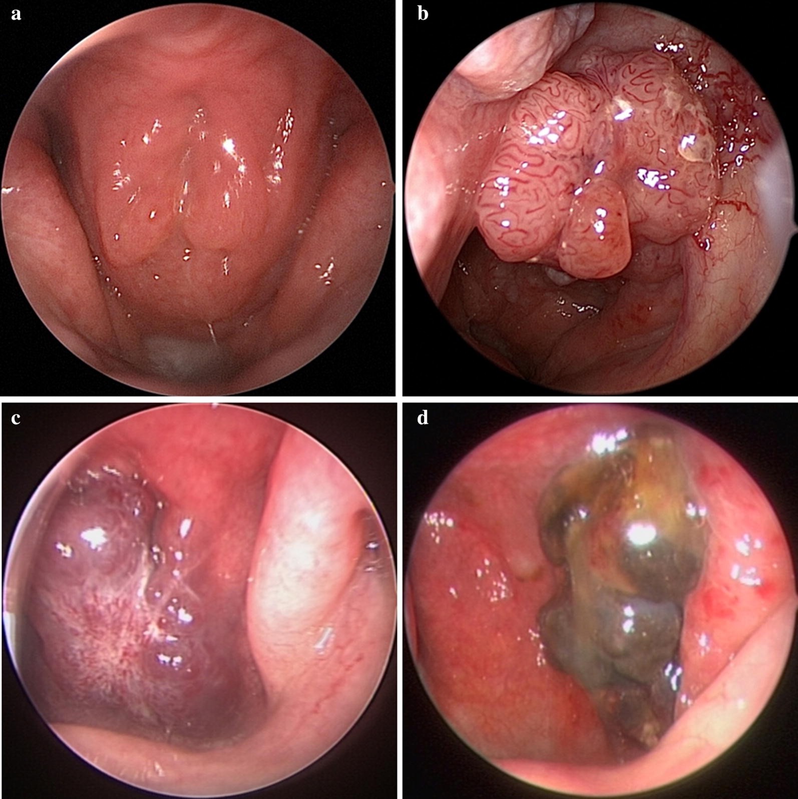 Fig. 2