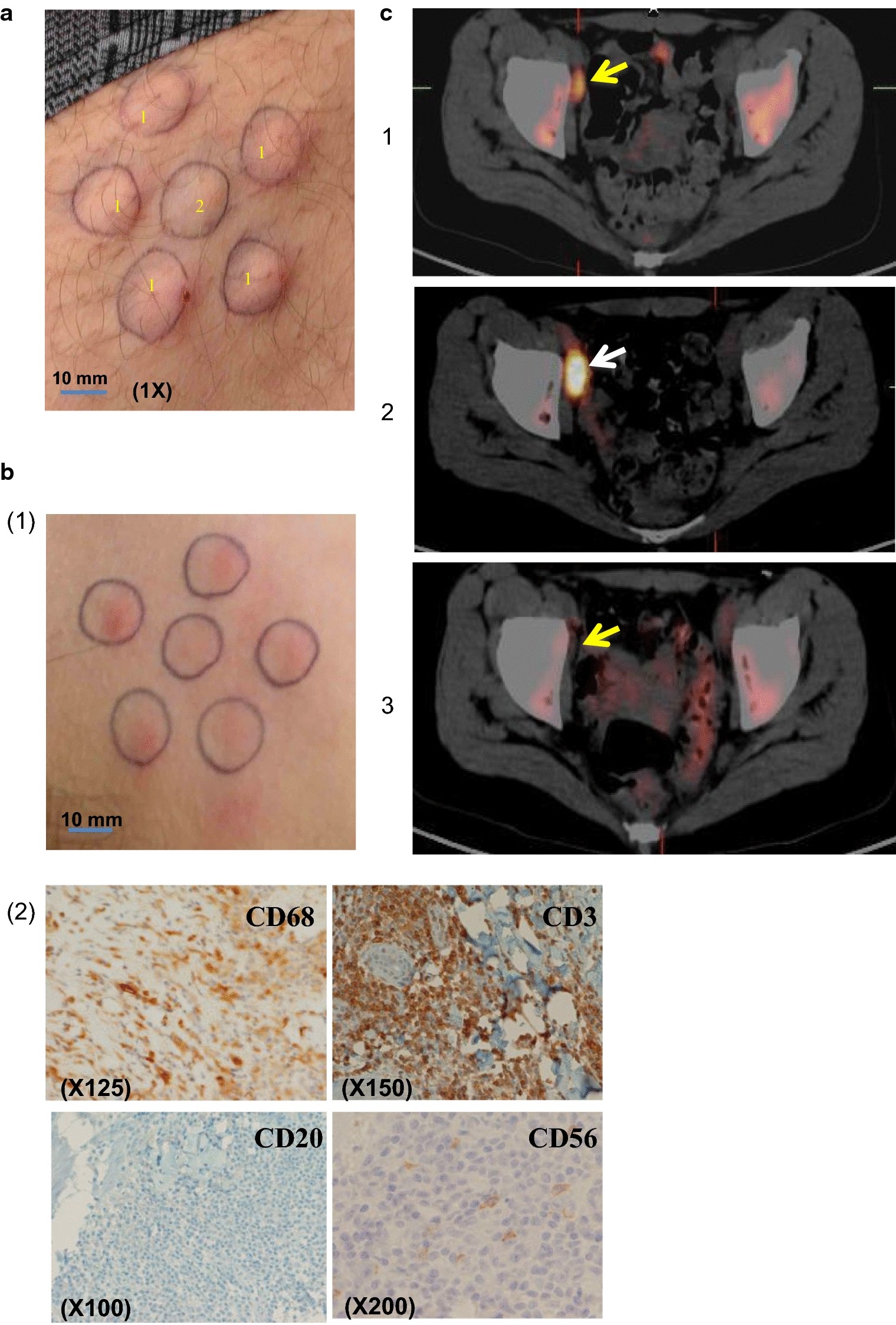 Fig. 3