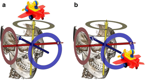 Fig. 1