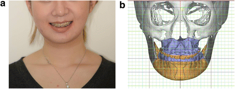 Fig. 9