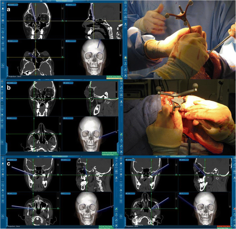 Fig. 4