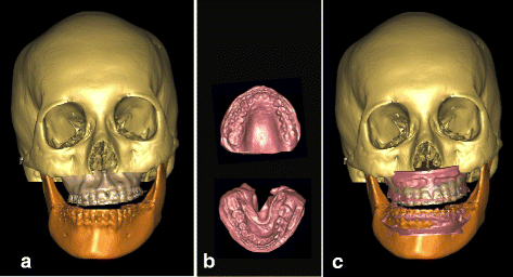 Fig. 3