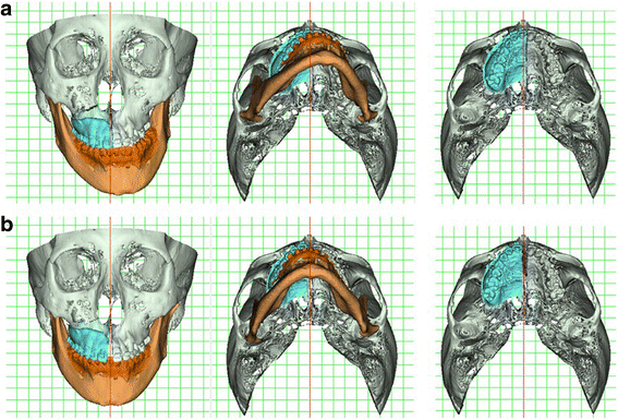 Fig. 12