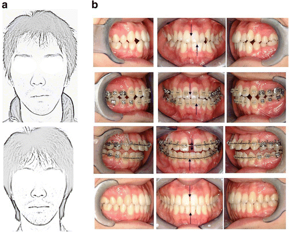 Fig. 13