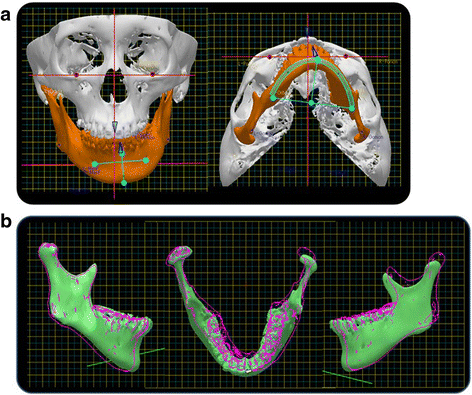 Fig. 15