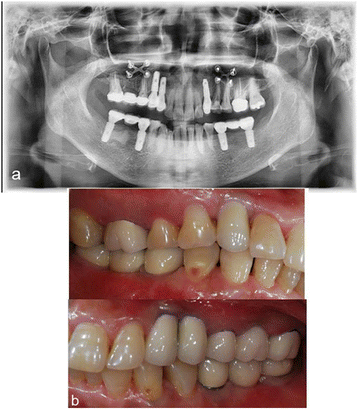 Fig. 3