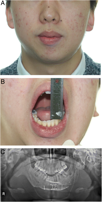 Fig. 8