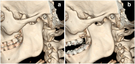 Fig. 8