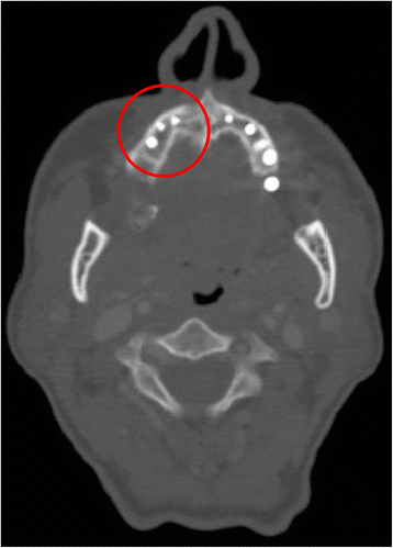 Fig. 13