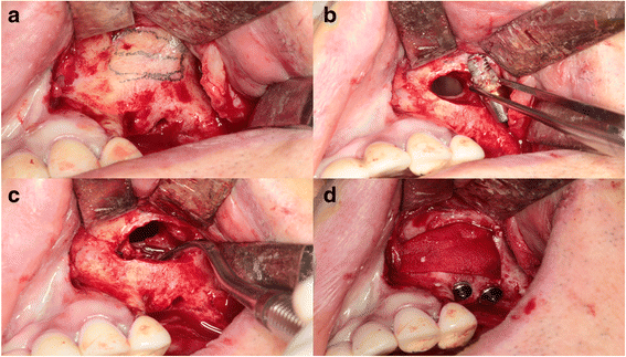 Fig. 3