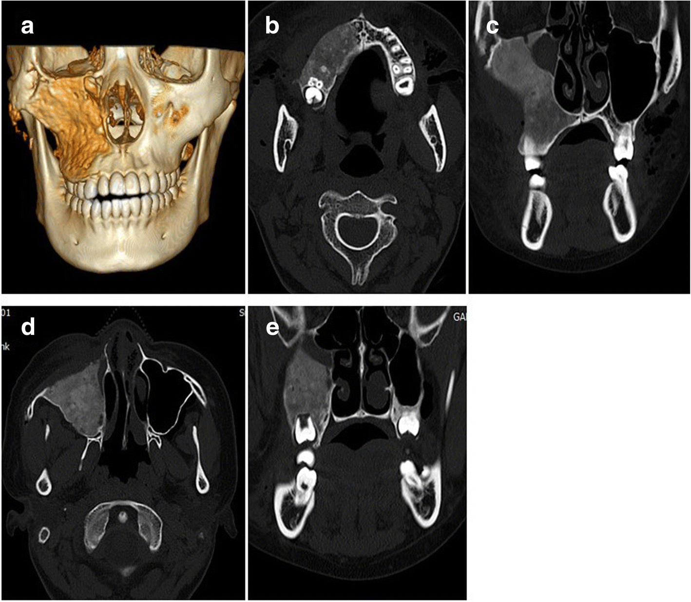 Fig. 6