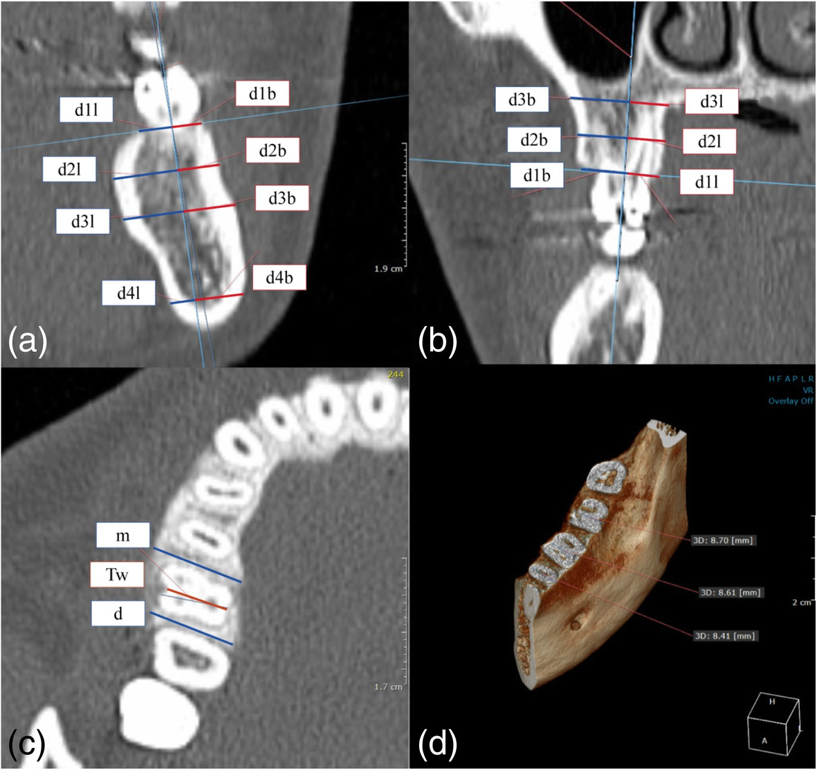 Fig. 2