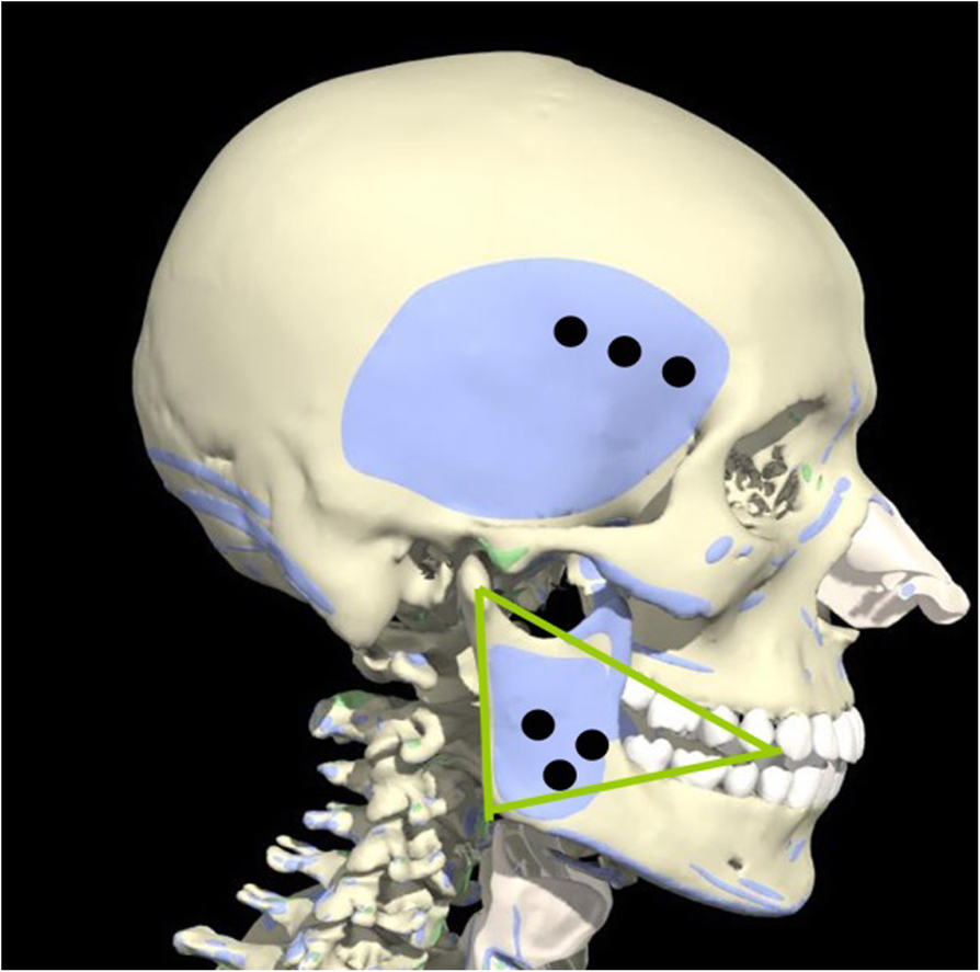 Fig. 10