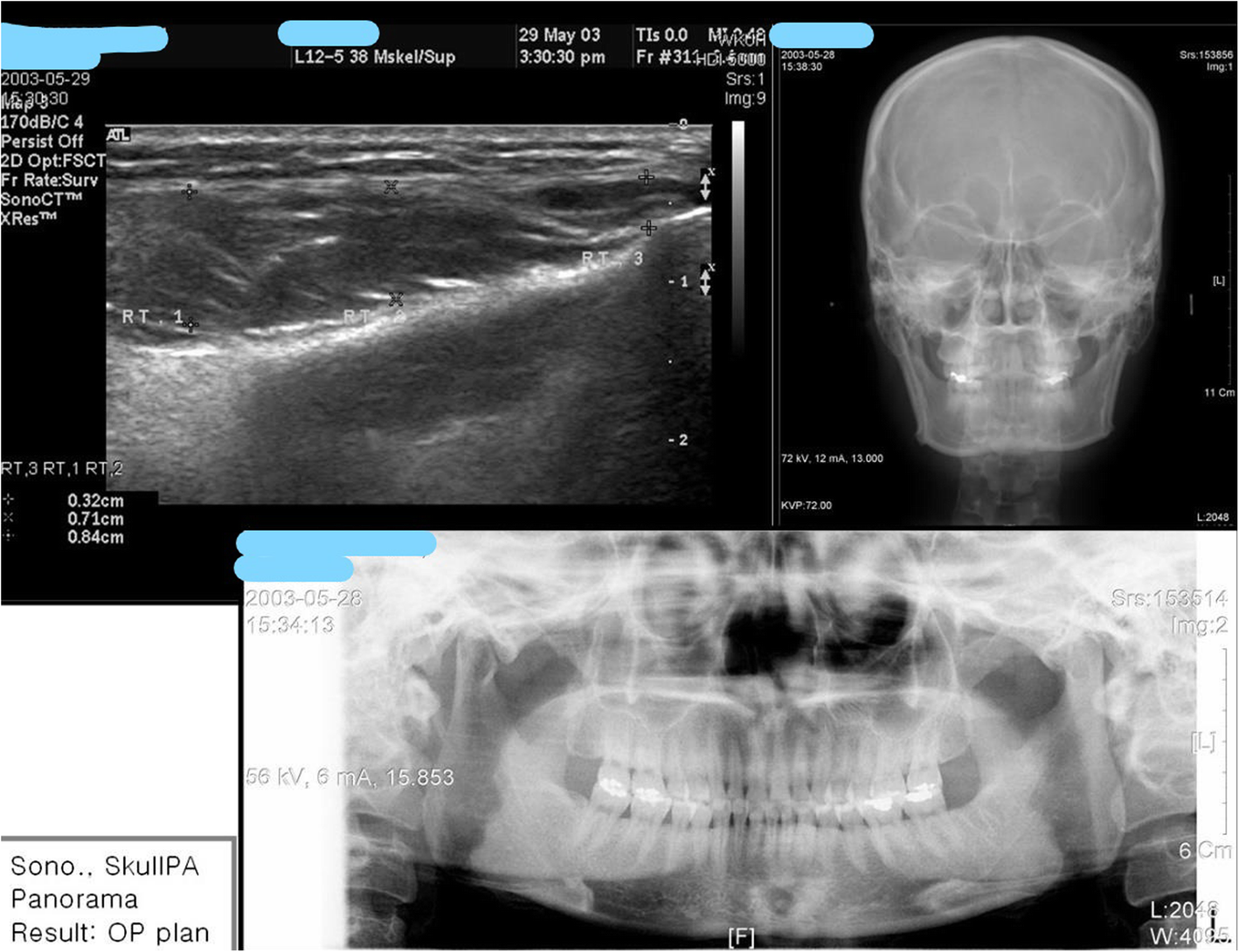 Fig. 9