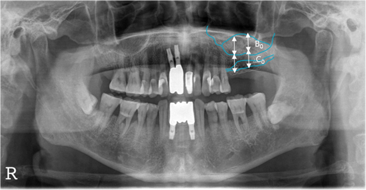 Fig. 3