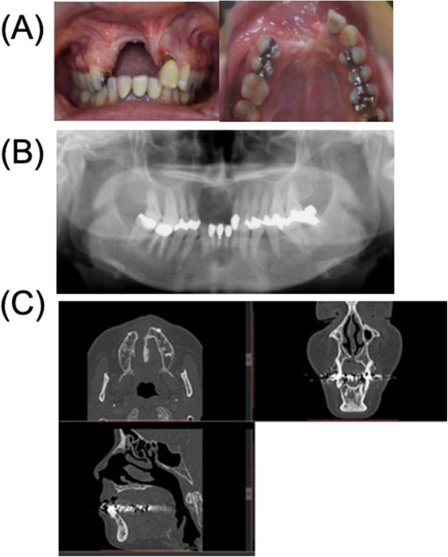 Fig. 2