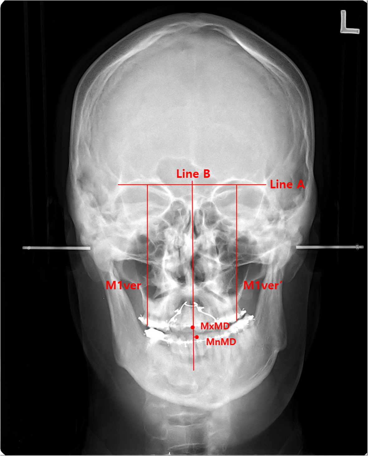 Fig. 1