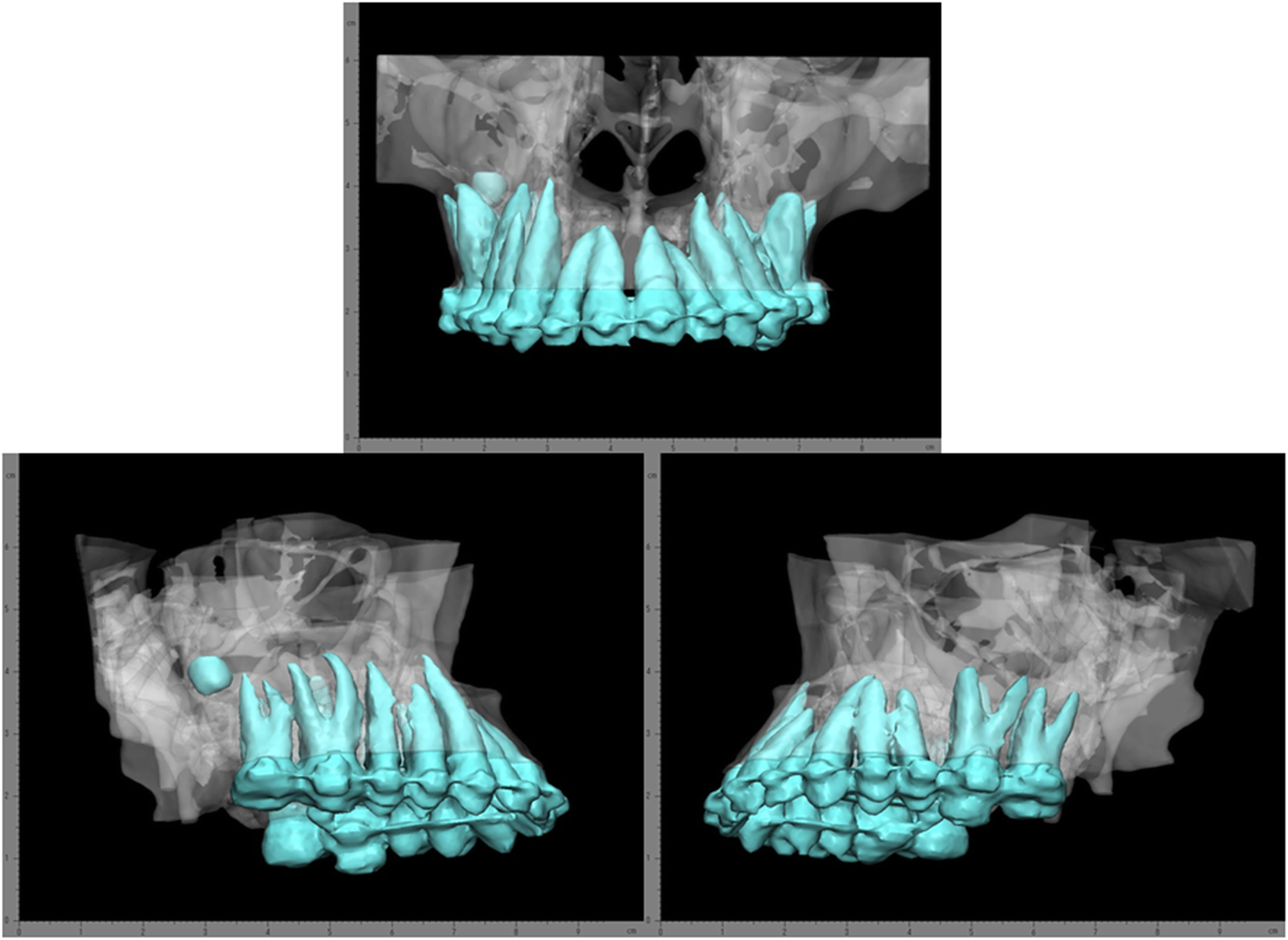 Fig. 1