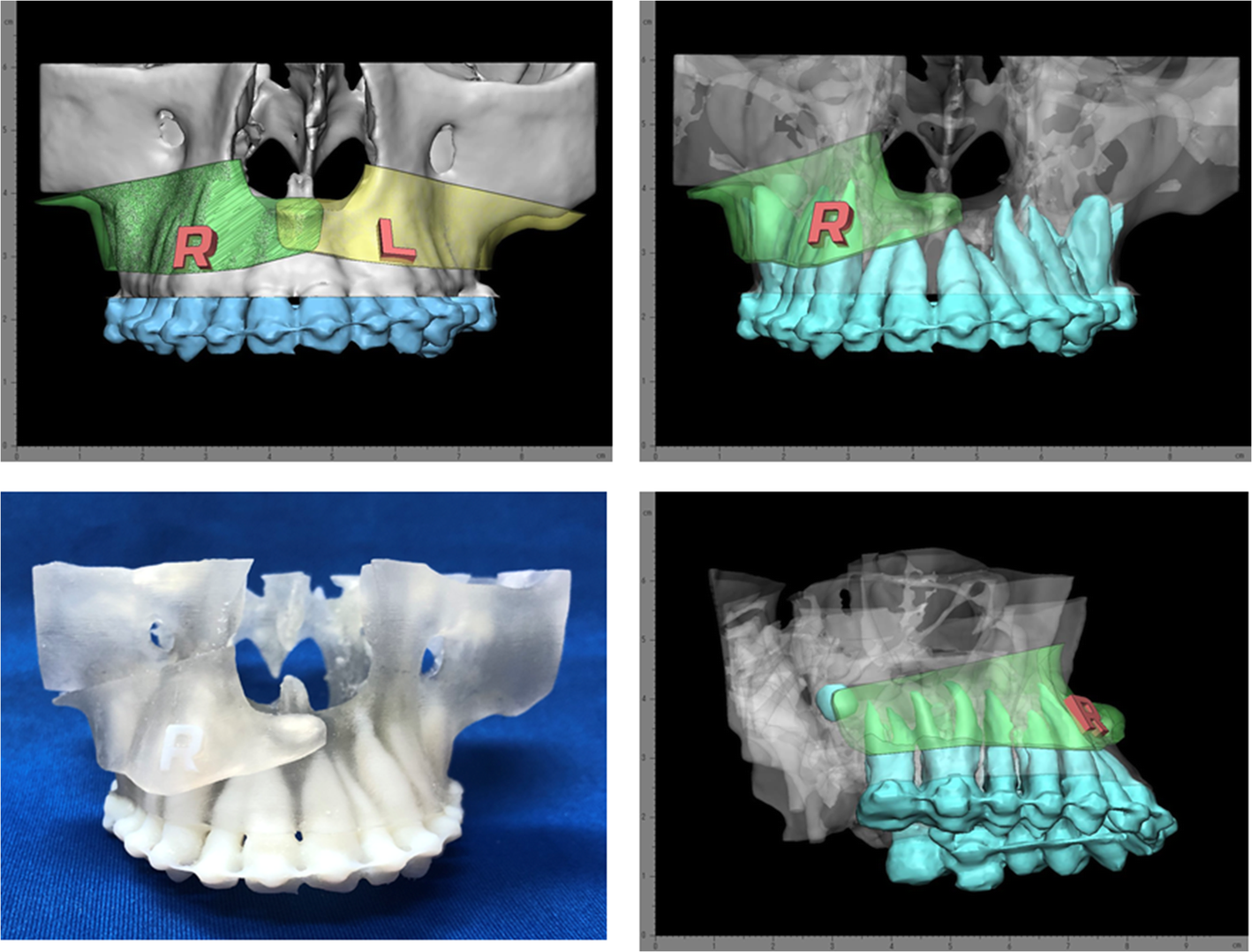 Fig. 2