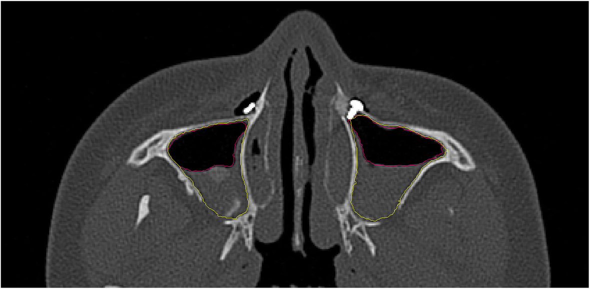 Fig. 2