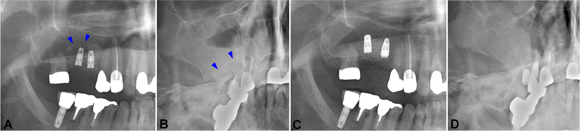 Fig. 2