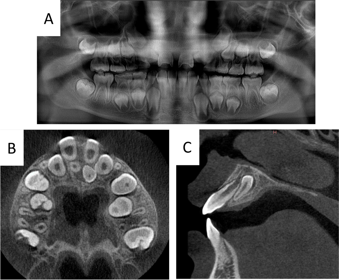 Fig. 2