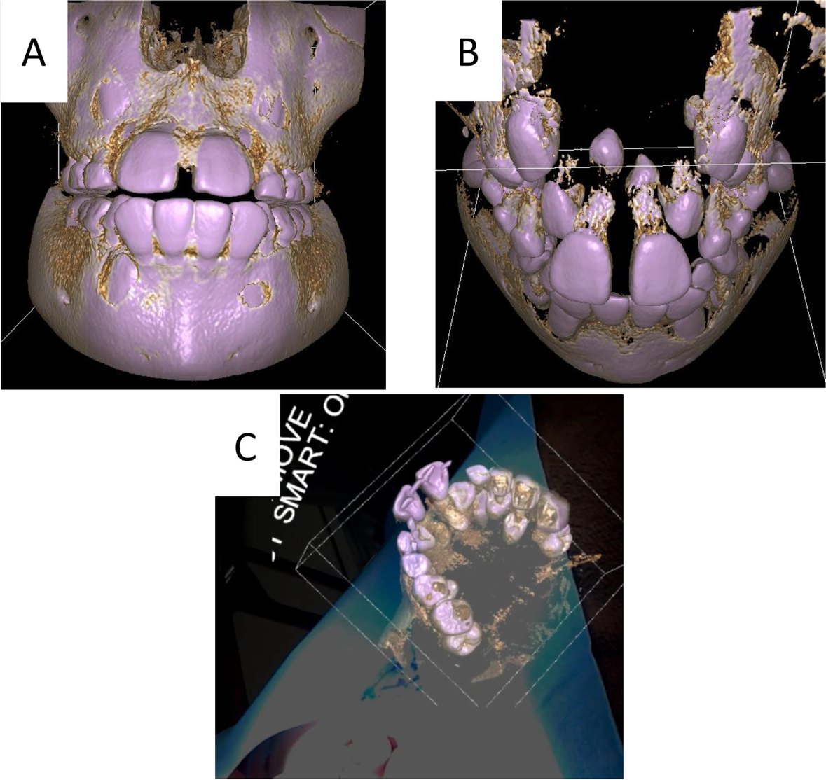 Fig. 3