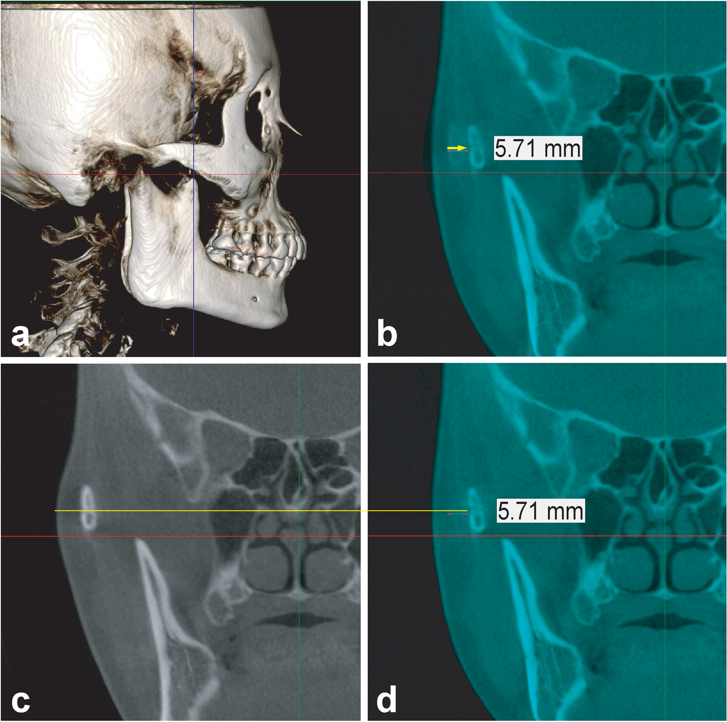 Fig. 3