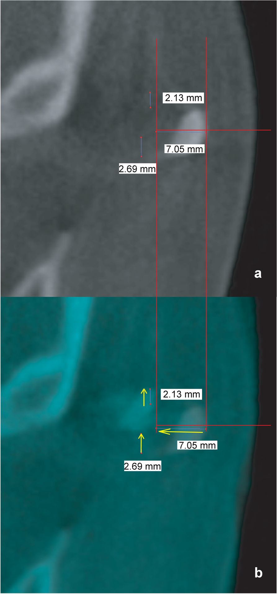 Fig. 4