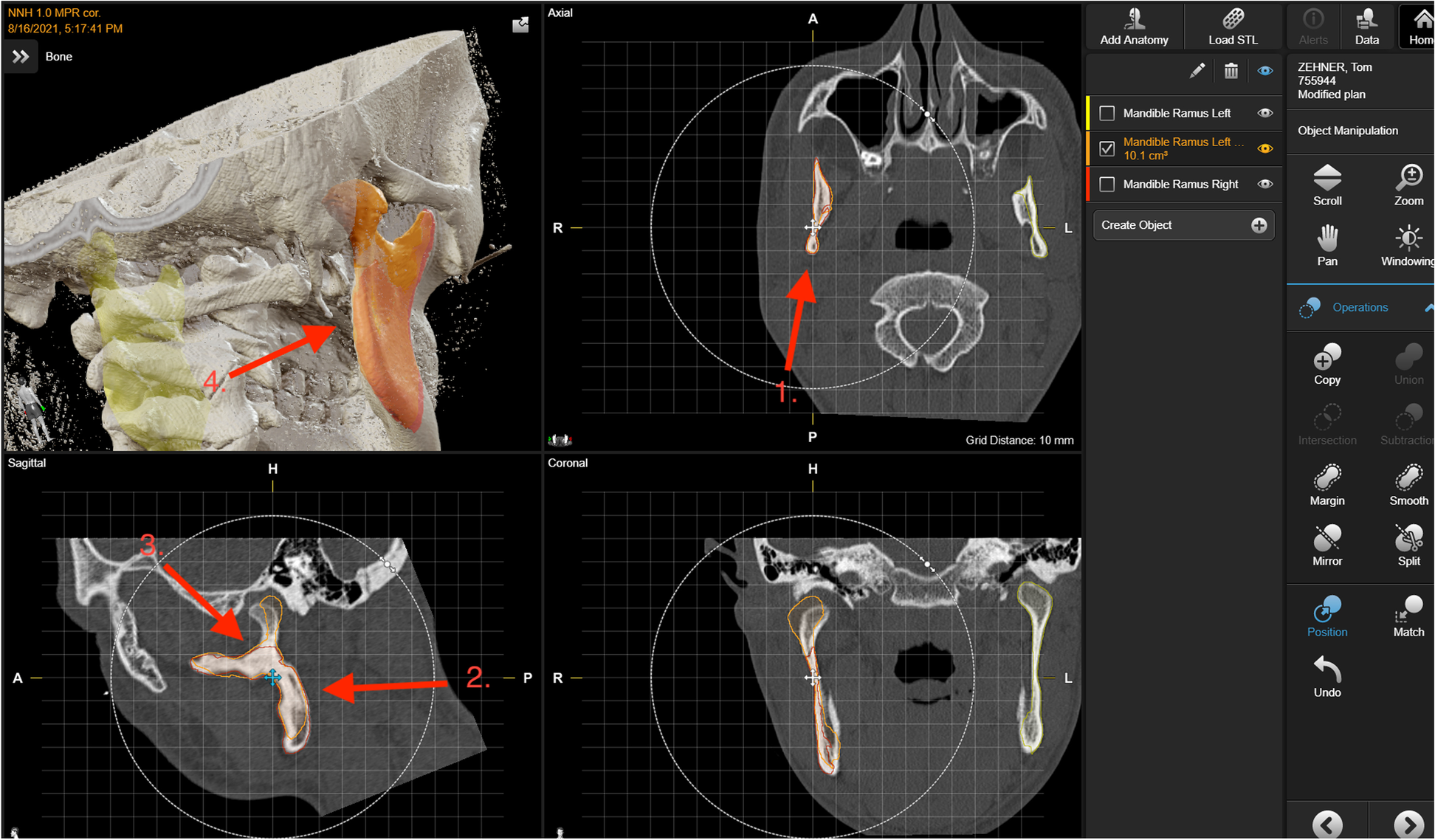 Fig. 1