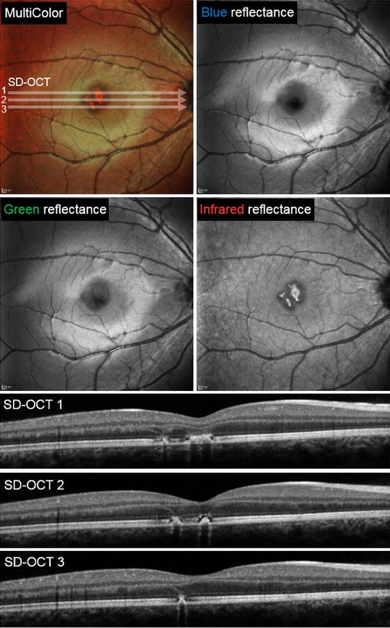 Fig. 2