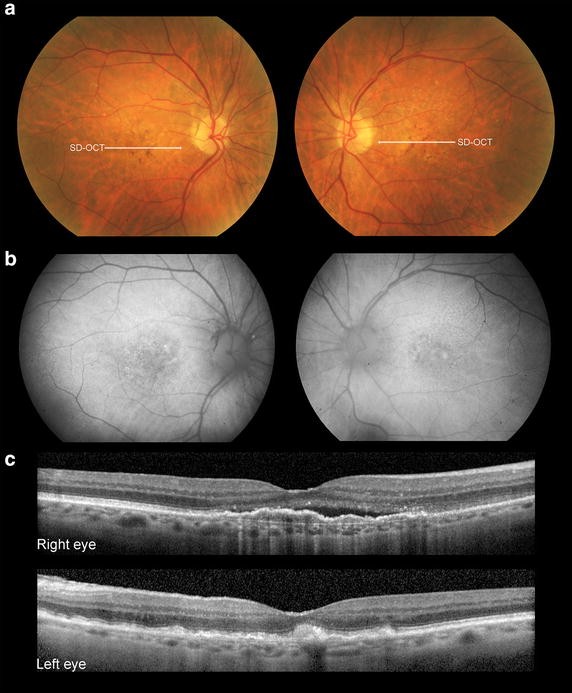 Fig. 3