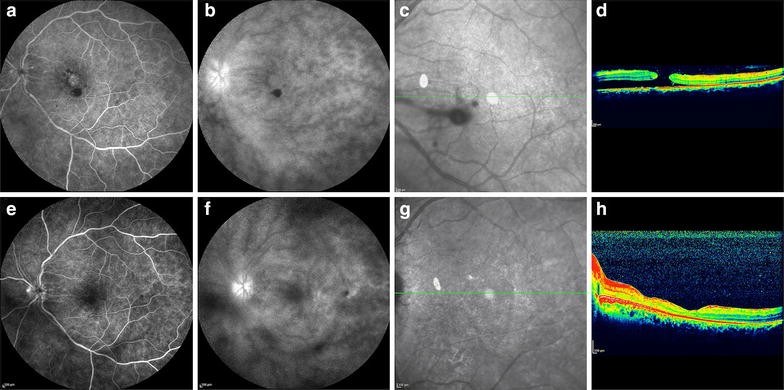 Fig. 1